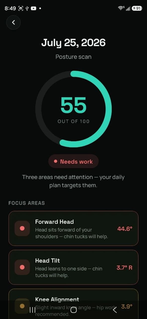 Vertebro posture scan showing a score of 55 and focus areas including forward head and head tilt